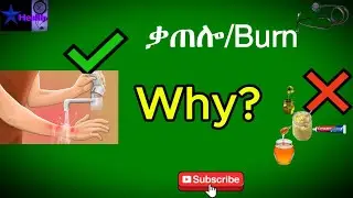 በቃጠሎ ጊዜ መወሰድ ያለባቸው መሠረታዊ የመጀመሪያ ደረጃ እርዳታዎች|Burn 1st aids