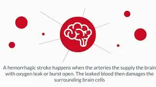 ControlTek: Stroke
