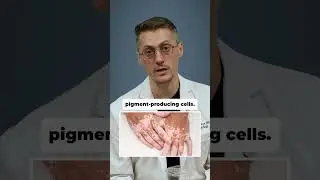 Is Vitiligo Contagious? Let's Clear It Up.