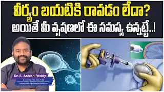 What is the Sperm Retrieval Process || Testicular Sperm Extraction || Micro TESE Procedure || Andro9