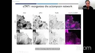 Cell Migration Seminars #54: Shailaja Seetharaman & Joseph D'Alessandro