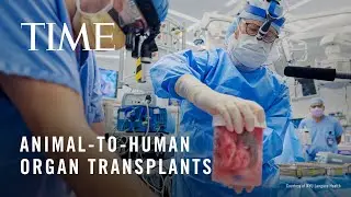 The Future of Organ Transplants Involves Pigs and 3D Printers