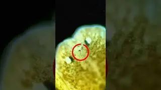 This microscopic worm has two heads and three eyes!