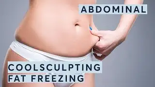 Fat Freezing | CoolSculpting Procedure @ Pulse Light Clinic -Abdominal
