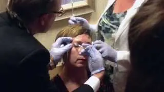 30 Second Botox Demo