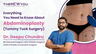 Everything You Need to Know About Tummy Tuck Surgery | The NewYou | Best Liposuction Hospital In Hyd