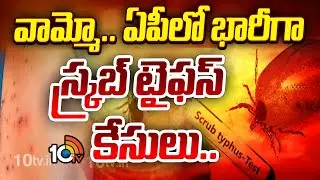 వామ్మో.. ఏపీలో భారీగా స్క్రబ్ టైఫస్ కేసులు.. | Scrub Typhus Cases Increasing In AP | 10TV News