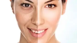 anti rides naturel - 2 conseils efficaces