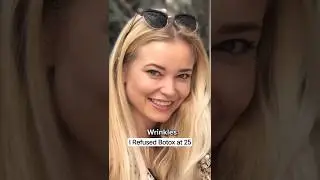 В 25 лет я отказалась от ботокса.