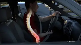 $1.5M Settlement on $500K Policy Limit Using Accident Reconstruction Animation