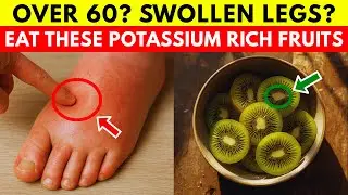 Seniors: Eat These Potassium Rich Fruits to Heal Swollen Legs!