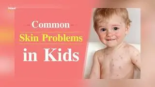 Common skin conditions in children || Life Matters || S01 EP19