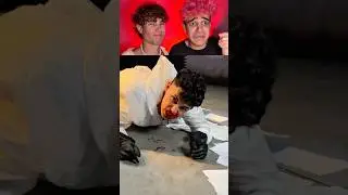 Un zombie muerde a Albertisment😰