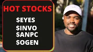 HOT STOCKS | Pre-Market Gainers - EYES stock INVO stock, ANPC stock, OGEN stock