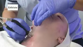 Dermal infusion facial