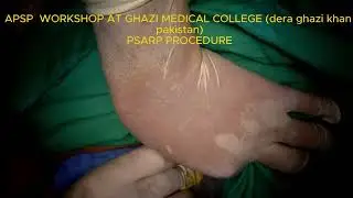 POSTERIOR SAGITTAL ANORECTOPLASTY #psarp#anorectal malformation #pediatrics #pediatricsurgeon