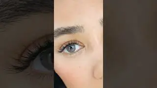 Lolite Anyone? Anesthesia Lenses Are 😍