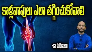 కాళ్ళ వాపులు ఎలా తగ్గించుకోవాలి | Home remedies for Leg Swellings | Dr.Madhu Babu Health Trends