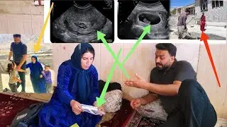 The fetus in danger: The heartbeat that shook Mohammad's heart: Cementing the yard