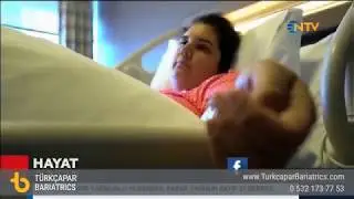 Tüp mide ameliyat öyküsü.