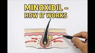 Minoxidil Explained Scientifically | How It Works, Uses & Side Effects| MALAYALAM