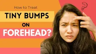 Why You Have Tiny Bumps on Forehead & How to Treat it