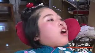 【双子で生まれてくれてありがとう】 #双子    #重度障害    #二十歳　#成人式 　#難病