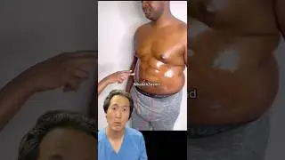 When NOT To Create a Six Pack With Liposuction!