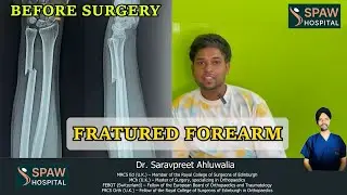 Fractured Forearm Surgery at Spaw Hospital | Patient Recovery Journey