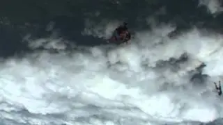 premature opening