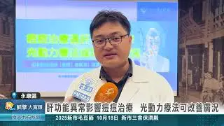 肝功能異常影響痘痘治療 光動力療法可改善膚況20251017