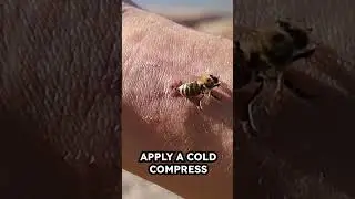 🩺 Первая помощь при укусе пчелы: что делать, если вас ужалили