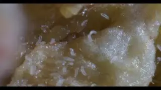 video eriofide del nocciolo con ripresa  supermacro