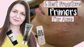 Лучшие аптечные праймеры для кожи, склонной к прыщам 2019 | Некомедогенные праймеры