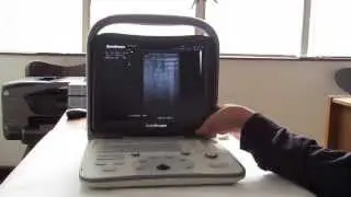 Ecógrafo Sonoscape A5V