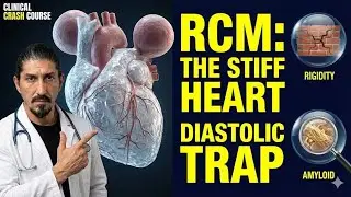 Restrictive Cardiomyopathy (RCM): The Concrete Heart Breakdown [2023 ESC Guide]