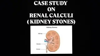 Case study on renal calculi/kidney stone✍️👩&zwj;🏫 #medicalsurgicalnursing #bscnursinggnm #likensubscribe