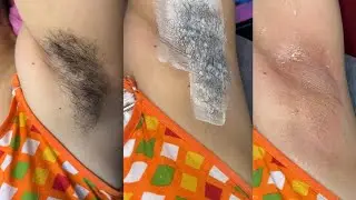 Armpit waxing by rica wax on sensitive skin/summer season waxing tips/ #waxingtips #beauty #skincare