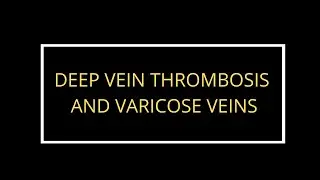 Varicose Veins are a risk for Deep Vein Thrombosis - DVT