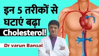 High Cholesterol से बचने के 5 तरीके| Dr. Varun Bansal | World Heart Day Special