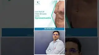 Gynecomastia is a condition that causes enlarged breasts in men. #cosmeticsurgeon #beauty #filler