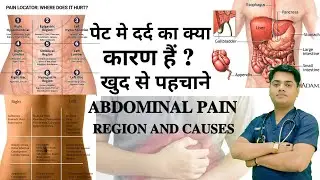 पेट के दर्द से समझे कौन सी बीमारी है? || abdominal pain || pet dard  