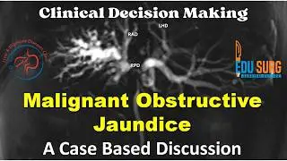 Case-based management of block at the liver hilum and hilar cholangiocarcinoma (Bile duct cancer)