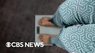 Nearly 70% of U.S. adults would be considered obese under proposed new definition, study finds