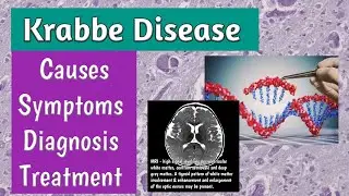 Krabbe Disease Causes, Symptoms, Diagnosis & Treatment | Globoid Cell Leukodystrophy | MRCPCH & FCPS