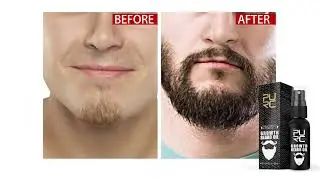 &Oacute;leo para Crescimento de Barba