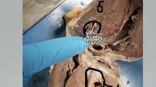 Sheep heart mock practical B 4-5