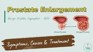 Prostate Enlargement: Symptoms, Causes & Treatment You MUST Know | BPH Warning Signs