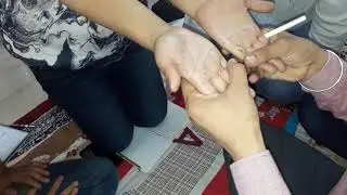 नाभि चेक करने का लाजवाब तरीका, हटी हुई नाभि को कैसे चेक करें,, Easy way to check Navel Displacement