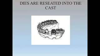 Laboratory Procedure in fixed dental prosthesis Part 1